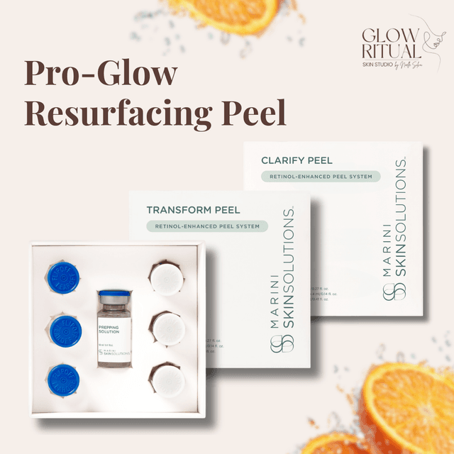 April Pro-Glow Peel Special at Glow Ritual Skin Studio in Warwick, RI